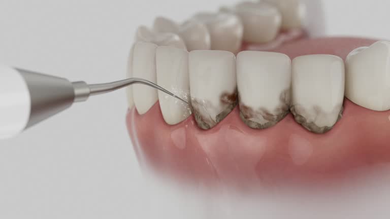 Trusted Tooth Extraction service in Starbuck, MN - Dentist Open Now